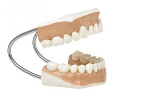 Model af tandsæt-0