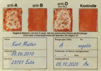 Blodtype bestemmelse, tør-imprægneret med antistof for ABO og Rho (D), pakke med 10 Eldon-kort-0