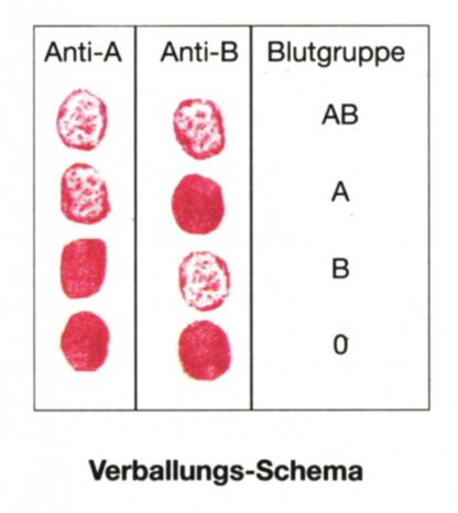 Eksperimentel Kit de Luxe: Kunstigt blod for blodtypebestemmelse med Rh (Ward's)-11192