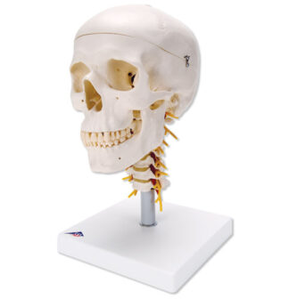 Skull on Cervical Spine,4-part