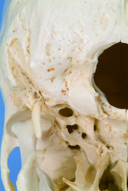 BONElike™ human knogle kranie model, i 6 dele-7149