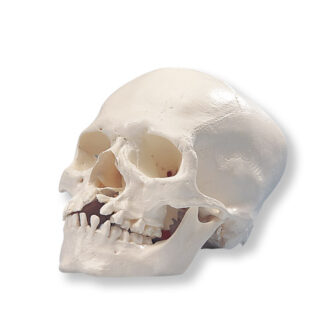 Microcephalic Skull