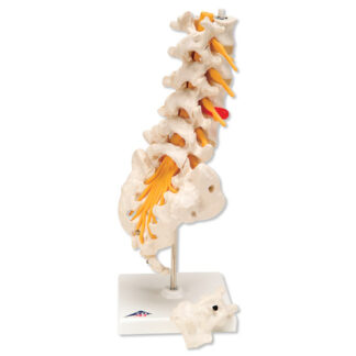 Lumbar rygsøjlen med dorso-lateral diskusprolaps intervertebral disc-0