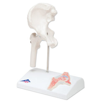 Mini Hip Joint withcross-section