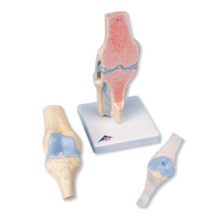 Sectional knee joint model3-part