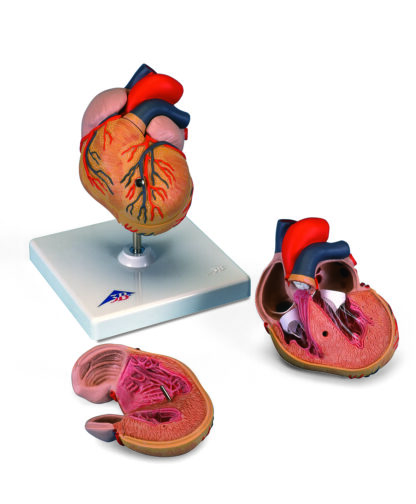 Klassisk hjerte model med venstre ventrikel hypertrofi (LVH), 2 dele-7471