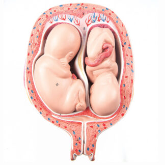 5. måned, tvillinge fostre i normalt leje-0