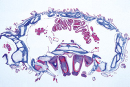 Echinodermata, Bryozoa andBrachiopoda - German