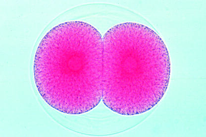 Sea Urchin Embryologi (Psammechinus miliaris) - tyske dias-9162
