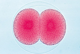 Sea Urchin Embryology (Psamm.miliaris) - German