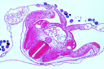 Kylling Embryologi (Gallus domesticus) - tyske dias-9172
