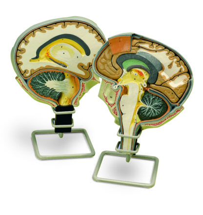 Hjerne Sektions model med medial og sagittal snit-9722