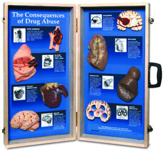 Consequences of Drug Abuse 3D Display